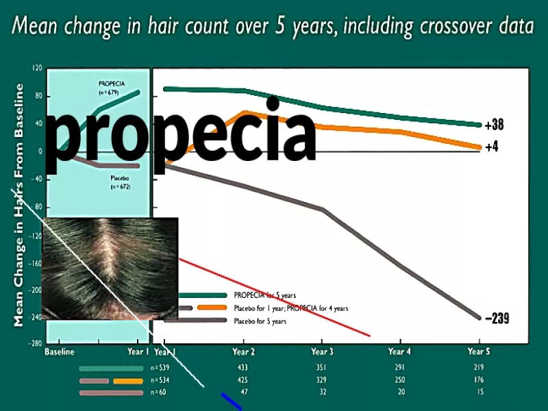 Propecia ligne frontale